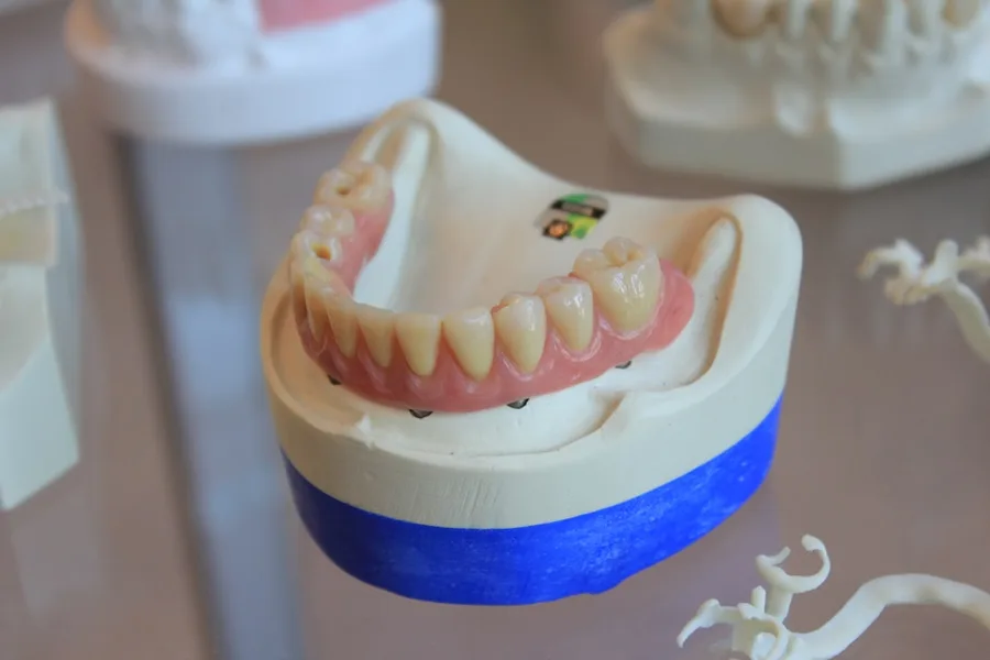 All-on-4 implant-supported smile at the Fort Myers dentist