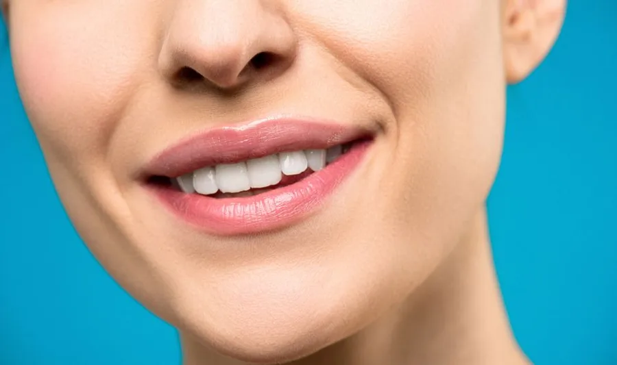 Close-up of a bright smile after teeth whitening in Fort Myers