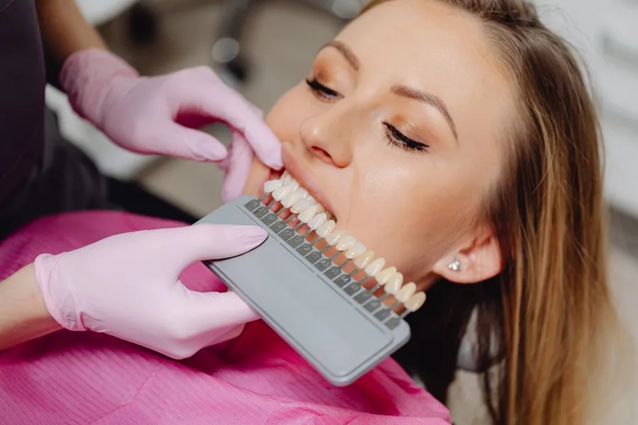 Whitening shade match at the Fort Myers dentist